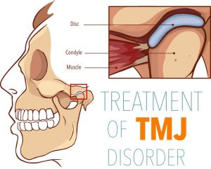 Oral Surgeon Treat TMJ